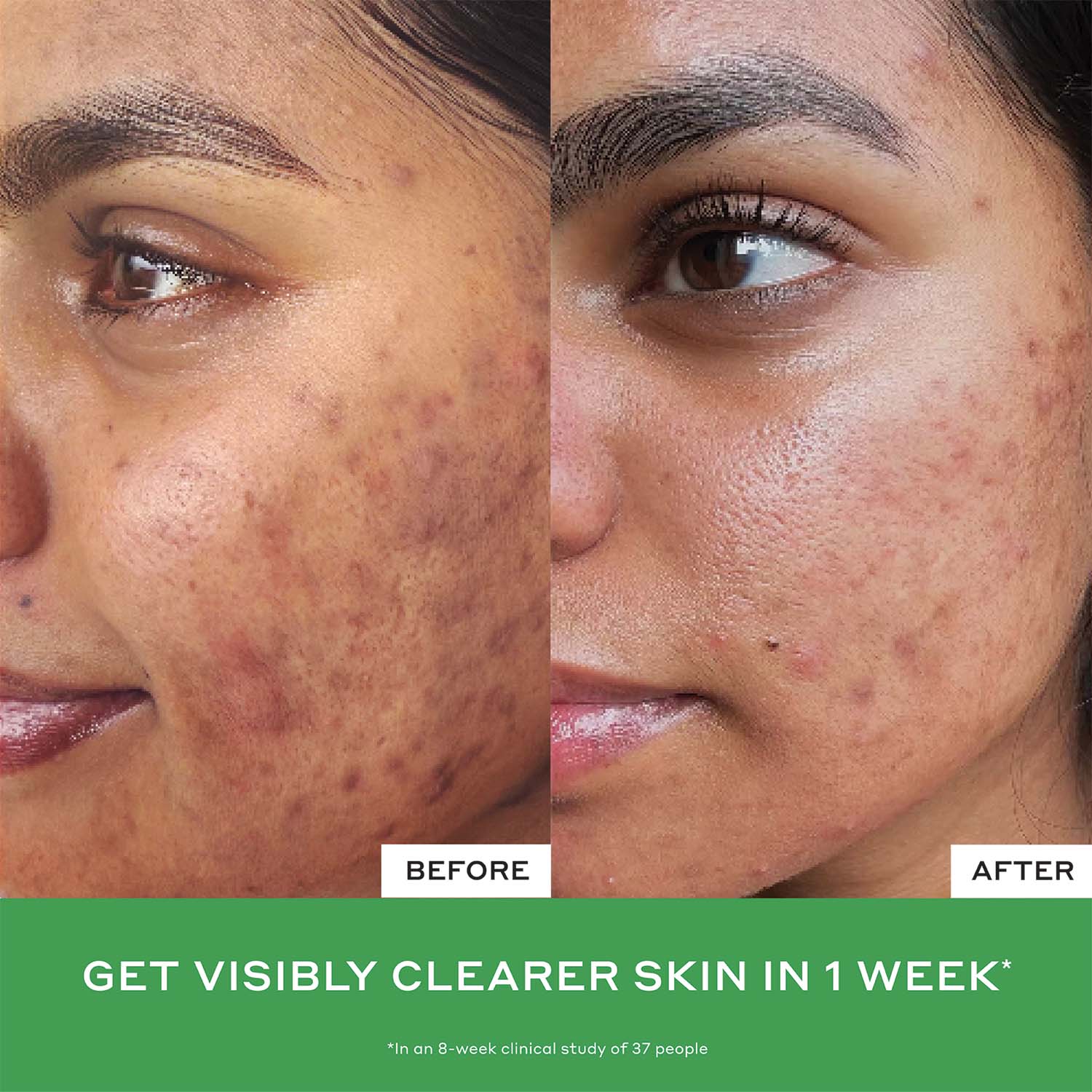 Daily D-Clog Pore-Clearing Cleanser - Image 9