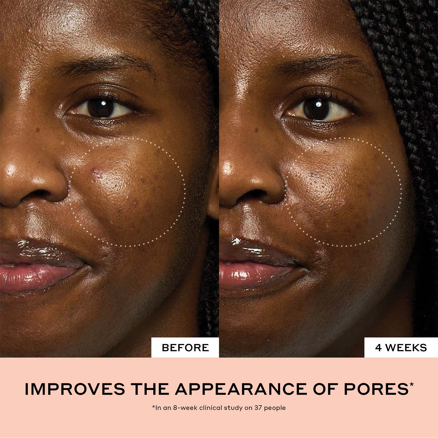 Peach Glaze Glow Niacinamide Serum with Vitamin C - Image 4